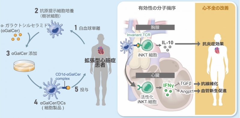 ナチュラルキラーT細胞活性化による新たな拡張型心筋症の治療法を開発